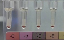 Phát hiện 2 người có nhóm ‘máu vàng’ hiếm nhất trên thế giới tại Trung Quốc