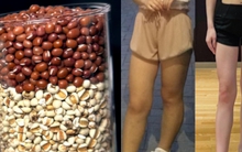 7 loại thực phẩm giúp loại bỏ phù nề, luôn có sẵn ở chợ Việt