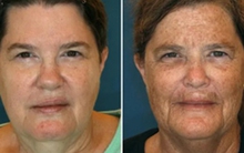 Cặp chị em sinh đôi nhưng ngoại hình như cách nhau 10 tuổi vì 2 thói quen