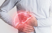 2 lý do khiến ung thư gan thường phát hiện muộn và dấu hiệu cảnh báo sớm