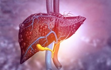 2 triệu chứng cảnh báo sớm ung thư gan, nếu có 1 cũng cần đi khám