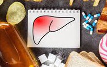 Những thực phẩm hại gan bậc nhất: Muốn sống lâu, sống khỏe, hãy tiêu thụ có chừng mực