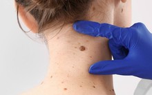 Tiến sĩ Anh tiết lộ 1 sai lầm phổ biến nhiều người mắc trong mùa đông làm tăng nguy cơ mắc ung thư