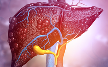 '5 sưng' trên cơ thể cảnh báo chức năng gan đang suy giảm nặng nề