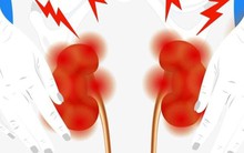 Thận ‘sợ’ nhất 10 hành vi này, trong đó rất nhiều thói quen thường gặp, đặc biệt ở nam giới