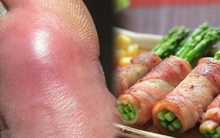 3 loại rau, 4 loại nước là "thủ phạm" gây bệnh gút: Đáng tiếc là nhiều người trong chúng ta đang làm sai