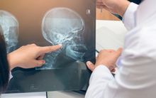 Cơ quan Y tế Quốc gia Anh: 5 triệu chứng cảm lạnh kéo dài có thể là dấu hiệu cảnh báo ung thư