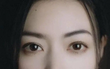 Nốt ruồi ở 4 vị trí này trên mặt ảnh hưởng nhiều đến sự nghiệp mà chẳng mấy người biết, vị trí số 3 hao hụt tài lộc thấy rõ