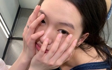 Gan khỏe hay không nhìn da là biết, thấy “đỏ, đen, vàng” này phải đi khám ngay