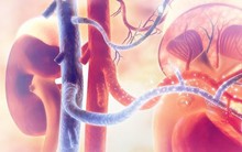 Người đàn ông phát hiện ung thư thận di căn sau khi có dấu hiệu bất thường này suốt 1 tháng