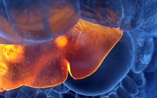 Khi gan bắt đầu suy hỏng, cơ thể sẽ có 8 điểm bất thường này: Dấu hiệu cuối cùng là ‘cảnh báo đỏ’