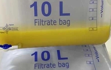 Đau bụng dữ dội, người đàn ông nhập viện 'hút ra 1 lít dầu' trong máu