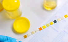 Khi thận suy hỏng, cơ thể sẽ có 2 điểm bất thường vào sáng và tối: Có 1 trong 2 cũng cần đi khám sớm