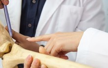 Xương suy yếu là “rào cản tuổi thọ”: 3 dấu hiệu đáng chú ý cảnh báo xương gặp vấn đề, có thể là ung thư