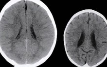 Xem ảnh chụp não đứa trẻ 3 tuổi thường bị cha mẹ la mắng, bác sĩ kết luận 1 câu khiến phụ huynh giật mình