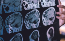 Nghiên cứu gây sốc: Ngồi 10 tiếng mỗi ngày làm tăng nguy cơ mất trí nhớ, dân văn phòng chột dạ vì ngày càng "não cá vàng"