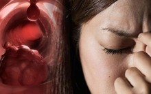 15 dấu hiệu 'siêu nhỏ' cảnh báo ung thư mà rất nhiều người bỏ qua