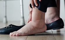 Thận khỏe hay yếu cứ nhìn 5 điểm bất thường này trên cơ thể: Phát hiện sớm để tự cứu mình