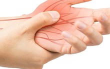 Khi mạch máu gặp vấn đề, tay và chân sẽ phát ra tín hiệu cảnh báo, nếu có cần đi khám sớm
