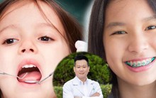 Bác sĩ chỉ ra thời điểm vàng nên bắt đầu chỉnh nha tăng trưởng và điều trị các vấn đề về răng cho trẻ