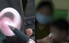 Bé 8 tuổi nhiễm trùng nội sọ, suýt mất mạng vì 1 thói quen khi rảnh rỗi