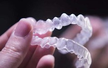 Những điều ít biết về phương pháp niềng răng từ thế giới cổ đại