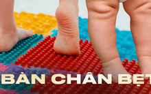 Một dấu hiệu ở bàn chân của con cảnh báo mắc phải dị tật mà 25% trẻ mắc phải