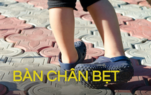 Dép Crocs gây tật bàn chân bẹt hay không? Chuyên gia giải đáp ngắn gọn, bất ngờ