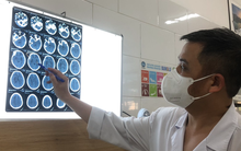 37 công nhân nhiễm độc methanol, 1 người tử vong, nhiều người nguy kịch