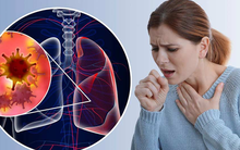 Không ốm sốt, chỉ đau thắt lưng, người phụ nữ đến BV Bạch Mai khám bất ngờ phát hiện ung thư phổi đã di căn: Cảnh báo 3 dấu hiệu quan trọng tuyệt đối không được bỏ qua