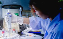 Nghiên cứu Đại học Oxford: Ăn thịt gà thường xuyên làm tăng nguy cơ mắc 3 loại ung thư nhưng có cách ăn để giảm nguy hiểm