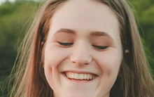 Tại sao một số người lại có má lúm đồng tiền?