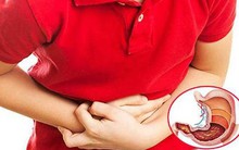 Những thói quen tưởng vô hại tàn phá dạ dày