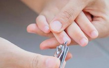 Kiểu cắt móng tay trông gọn gàng nhưng có thể gây mưng mủ, nhiễm trùng huyết