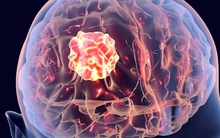 Bác sĩ tiên lượng chỉ sống thêm 1-2 năm, người đàn ông vẫn khỏe mạnh sau gần 2 thập kỷ