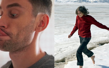 Những đặc điểm cơ thể ngỡ bình thường nhưng hóa ra thuộc phần hiếm của dân số thế giới