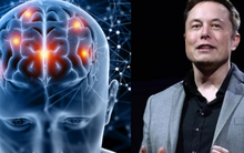 Triển vọng thử nghiệm cấy chip của công ty Neuralink