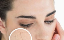 Những thực phẩm không nên ăn vào mùa hè kẻo cơ thể ‘héo khô’ vì mất nước