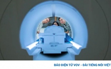 AI có thể đọc suy nghĩ của con người và biến thành văn bản