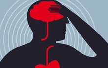 Nghiên cứu: Những người bị đau ở vùng này có nguy cơ mắc đột quỵ sớm hơn