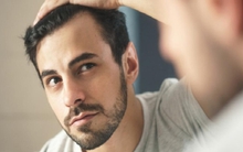 Bao lâu nên gội đầu 1 lần? Bác sĩ nói câu trả lời phụ thuộc vào 3 yếu tố