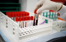 Hy vọng mới từ xét nghiệm ung thư đột phá