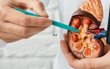 4 dấu hiệu cảnh báo thận có khối u, rất dễ bị bỏ qua