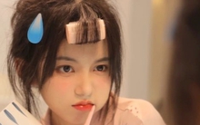 6 dấu hiệu 'vạch trần' bệnh ung thư dễ thấy khi bạn nhìn vào gương