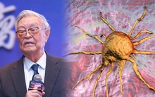 4 sở thích ăn uống độc hại có nguy cơ dẫn đến ung thư