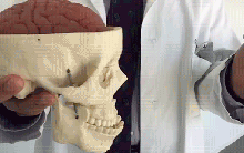 Khi não bị chấn động, cơ thể con người sẽ xảy ra chuyện gì?