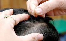 Nghiên cứu của Đại học Harvard chỉ ra mối liên hệ giữa tóc bạc và ung thư: Thực hư ra sao?