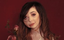 Bị chế giễu là "quái vật", bé gái vượt lên nghịch cảnh trở thành niềm tự hào của nước Anh, kiếm tiền tỷ mỗi năm