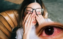 Chuyên gia chỉ rõ nguyên nhân khiến nhiều người bị đau mắt đỏ trong thời điểm hiện tại