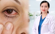 Bác sĩ chỉ ra nguyên nhân gây bệnh đau mắt đỏ ở người lớn và dấu hiệu cần đi khám ngay